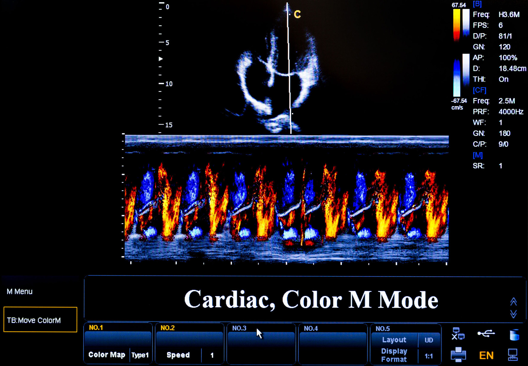 59211861 - modern echocardiography (ultrasound) machine monitor. colour image. new hospitl equipment. cardiac, colour m mode.