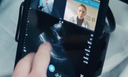 Philips Integrates Reacts Tele-Ultrasound Platform on Lumify Portable System